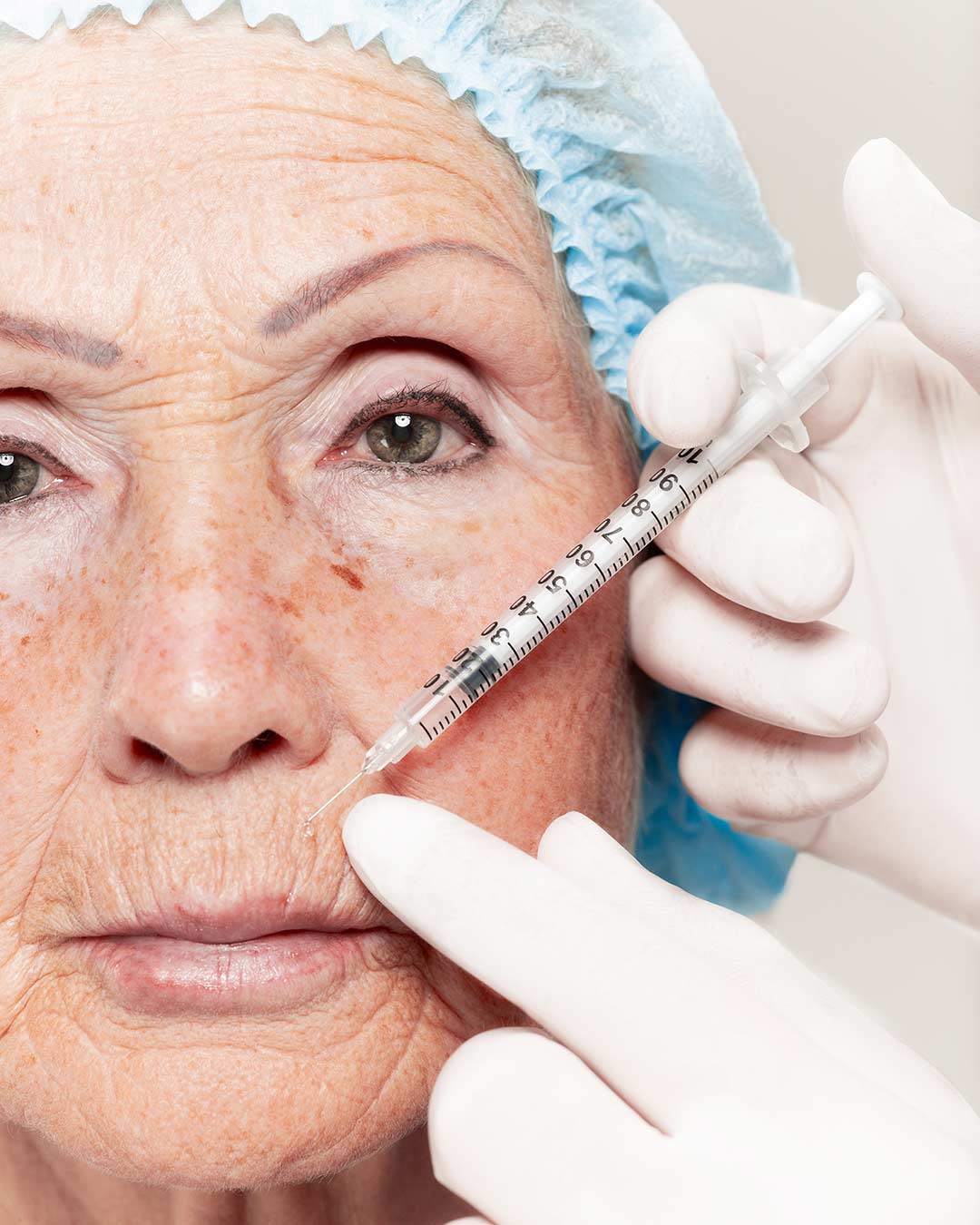 arrugas-profundas-principal-ok